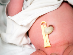 Umbilical cord care – Health Information