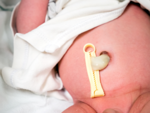 Knowing all there is to know about the umbilical cord